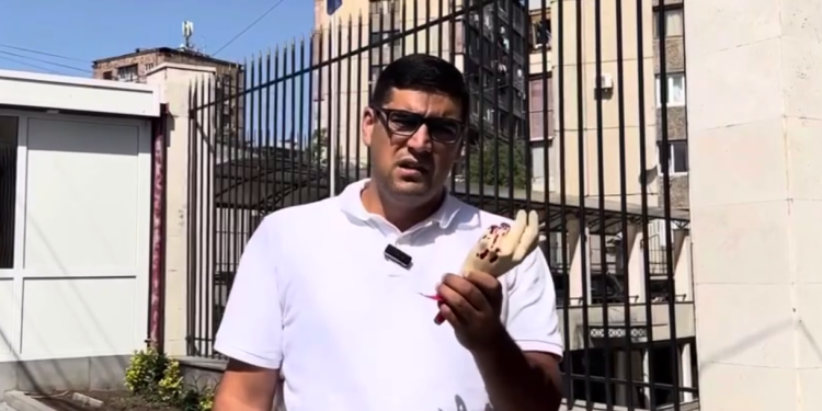 Լրագրող Բորիս Մուրազին ԵՄ դեսպանին է փոխանցել ոստիկանական բռնության հետևանքով քաղաքացու կտրված դաստակի սիմվոլը։