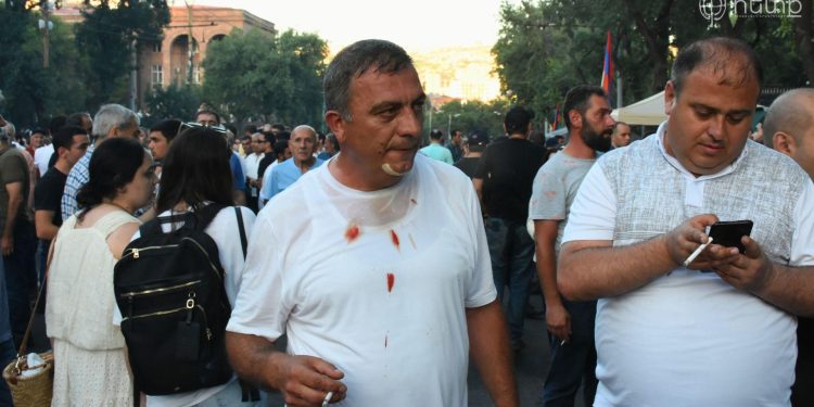 Եթե դուք տուժել եք հունիսի 12-ին ոստիկանության զորքերի ոչ իրավաչափ գործողություններից, դիմեք մեզ, կօգնենք. «Հայաքվե»