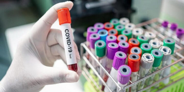 COVID-19-ի դեպքերը նախորդ տարվա նույն ժամանակահատվածի համեմատ մի փոքր ավելացել են