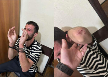 Պարեկների կողմից փաստաբան Ռոման Երիցյանի եղբոր ծեծի գործով ծառայողական քննություն է նշանակվել