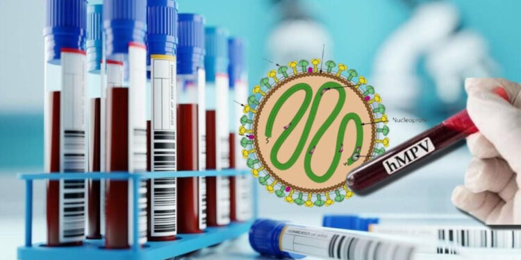 Ի՞նչ է մետապնևմավիրուսը, ինչպե՞ս կանխարգելել այն. ՀՎԿԱԿ-ի հորդորը