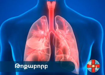 Թոքաբորբով հիվանդացության ռիսկը կանխել հնարավոր է՝ պատվաստվելով սեզոնային գրիպի դեմ. ԱՆ