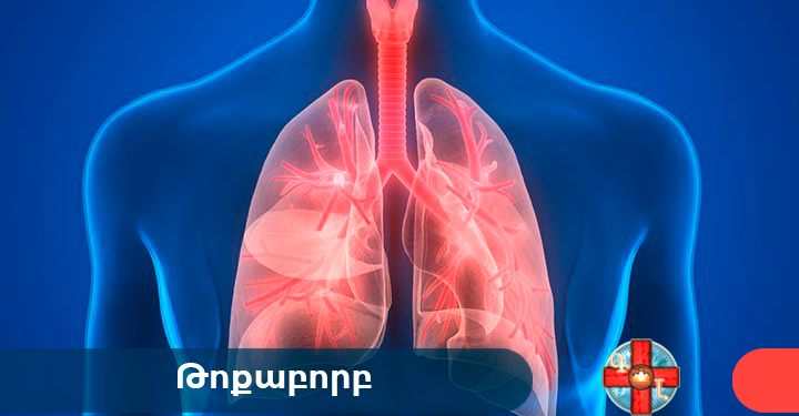 Թոքաբորբով հիվանդացության ռիսկը կանխել հնարավոր է՝ պատվաստվելով սեզոնային գրիպի դեմ. ԱՆ