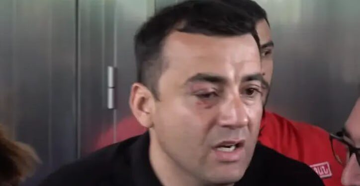 Արթուր Չախոյանին մեղադրանք է առաջադրվել