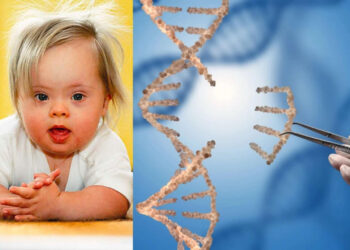 Ճապոնացի գիտնականները լաբորատոր պայմաններում հեռացրել են Դաունի համախտանիշ առաջացնող ավելորդ քրոմոսոմը