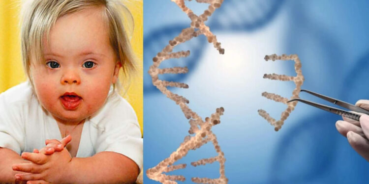 Ճապոնացի գիտնականները լաբորատոր պայմաններում հեռացրել են Դաունի համախտանիշ առաջացնող ավելորդ քրոմոսոմը