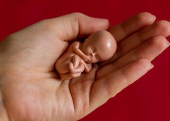 Հայաստանում աբորտների արգելք չի նախատեսվում․ ՀՀ ԱՆ