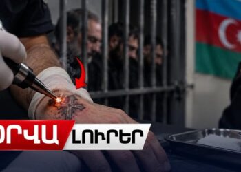Բաքվում հայ գերիների խաչի տեսքով դաջվածքը մաշկից հեռացվել է այրելով